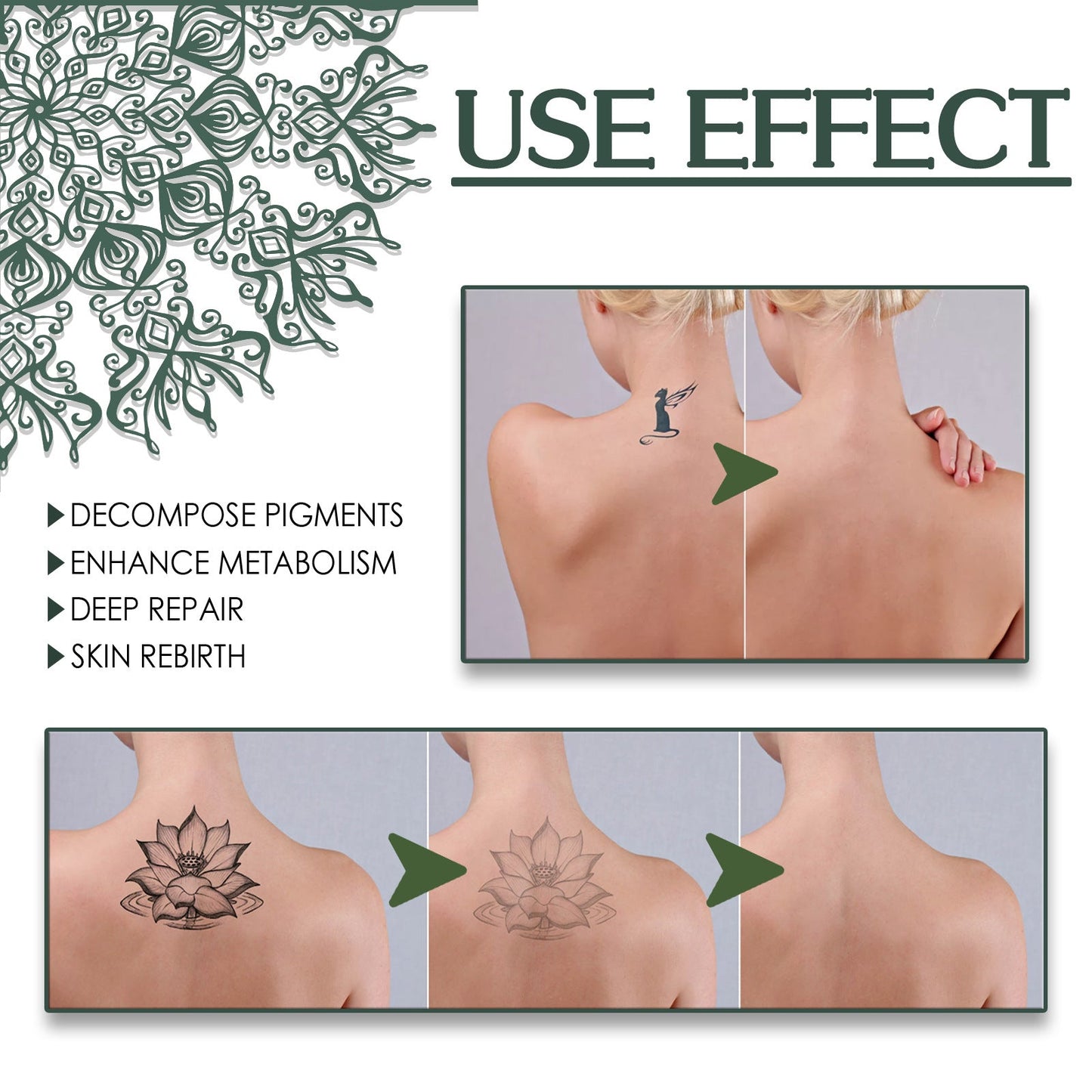 Spray effaceur de tatouage aux algues vertes pour réduction progressive des pigments et mélanine, flacon 30ml