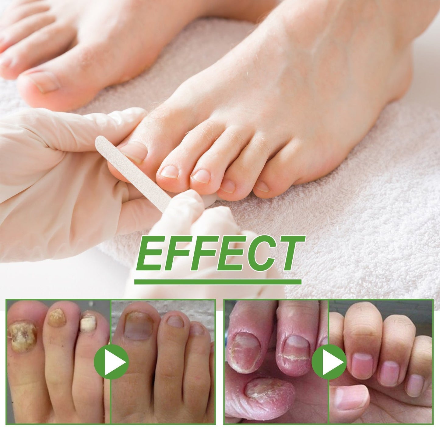Roller soin ongles solution épaississante anti-fragilité 10ml pour renforcer et réparer ongles fragiles