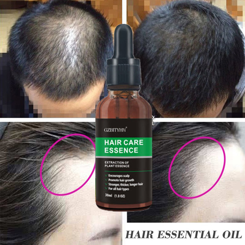 Huile Essentielle Croissance Capillaire – Anti-Chute, Nourrissante & Apaisante Cuir Chevelu, 30ml