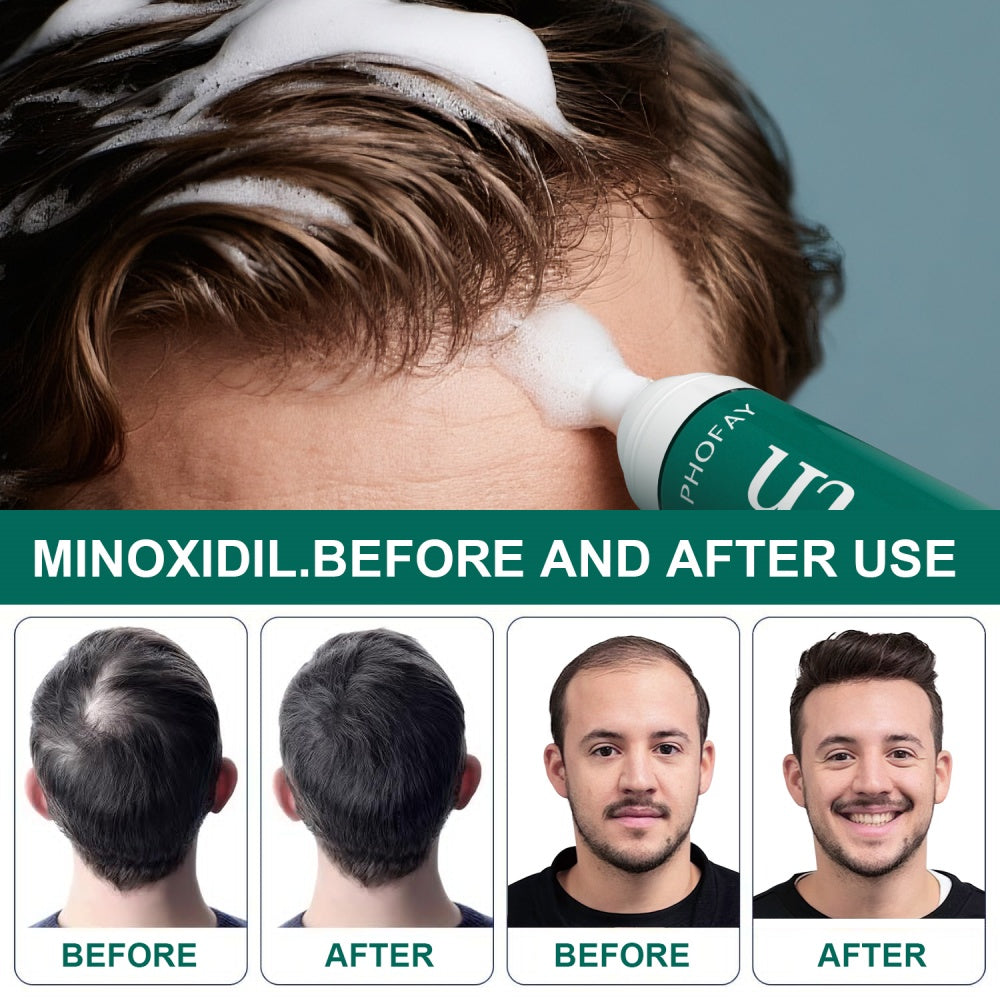 Mousse anti-chute au minoxidil pour stimuler la repousse et renforcer les cheveux