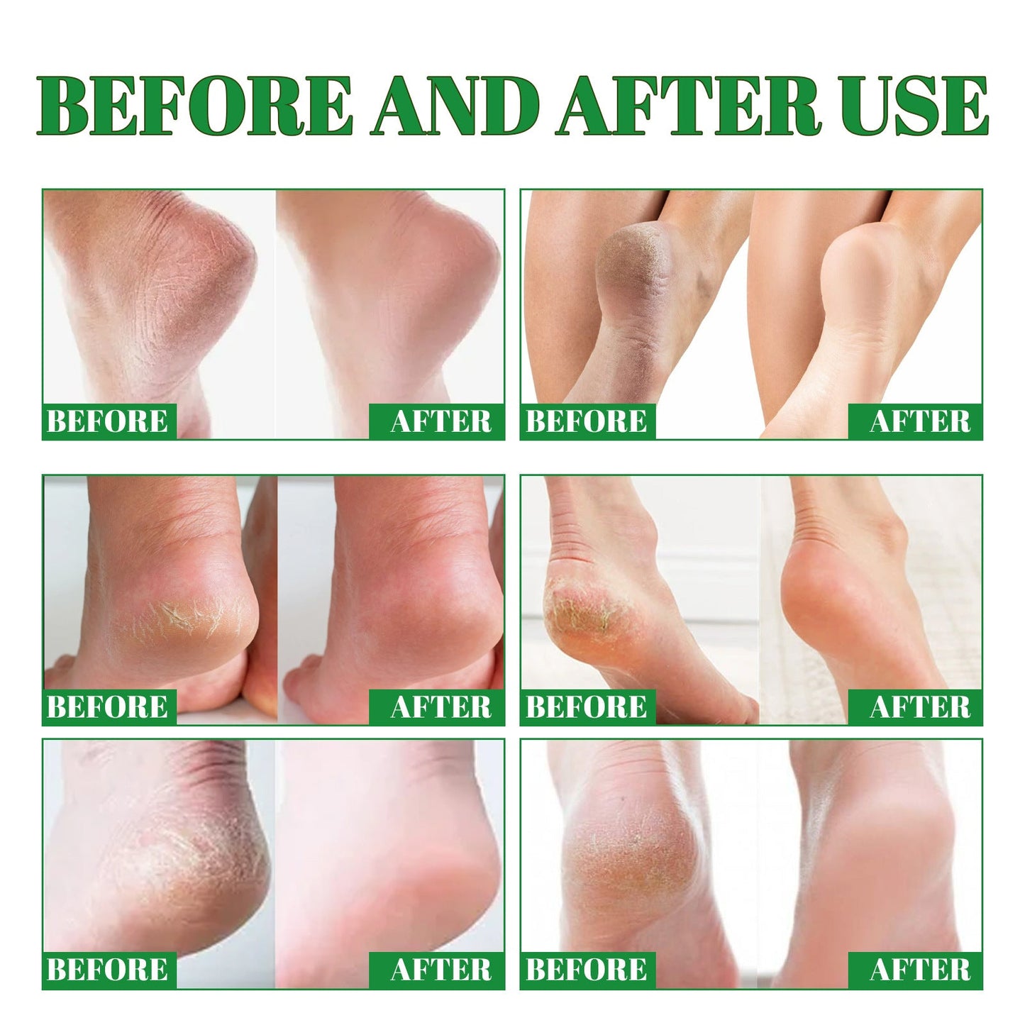 Crème Hydratante Pieds nourishing foot cream with shea butter and lavender oil for dry heels care
