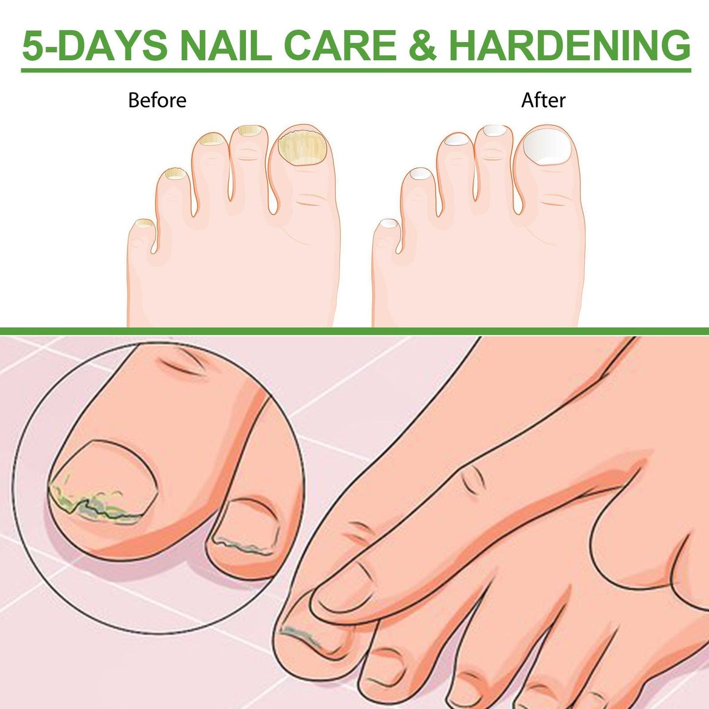 Roller soin des ongles 10ml solution épaississante anti-fragilité pour ongles forts et réparés
