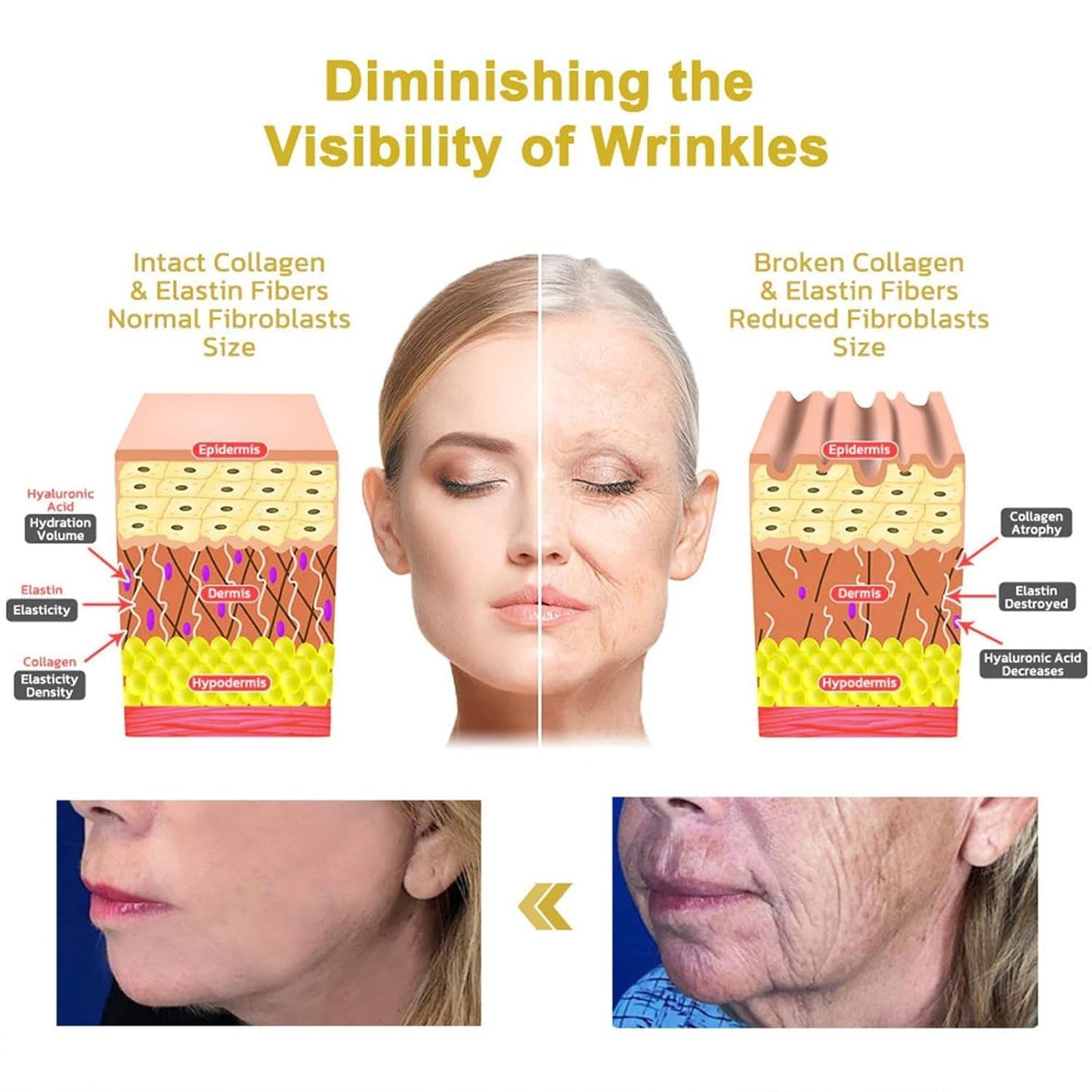 Sérum raffermissant visage BeeVenom facial avec effet lifting naturel au venin d'abeille pour peau rajeunie et collagène stimulé