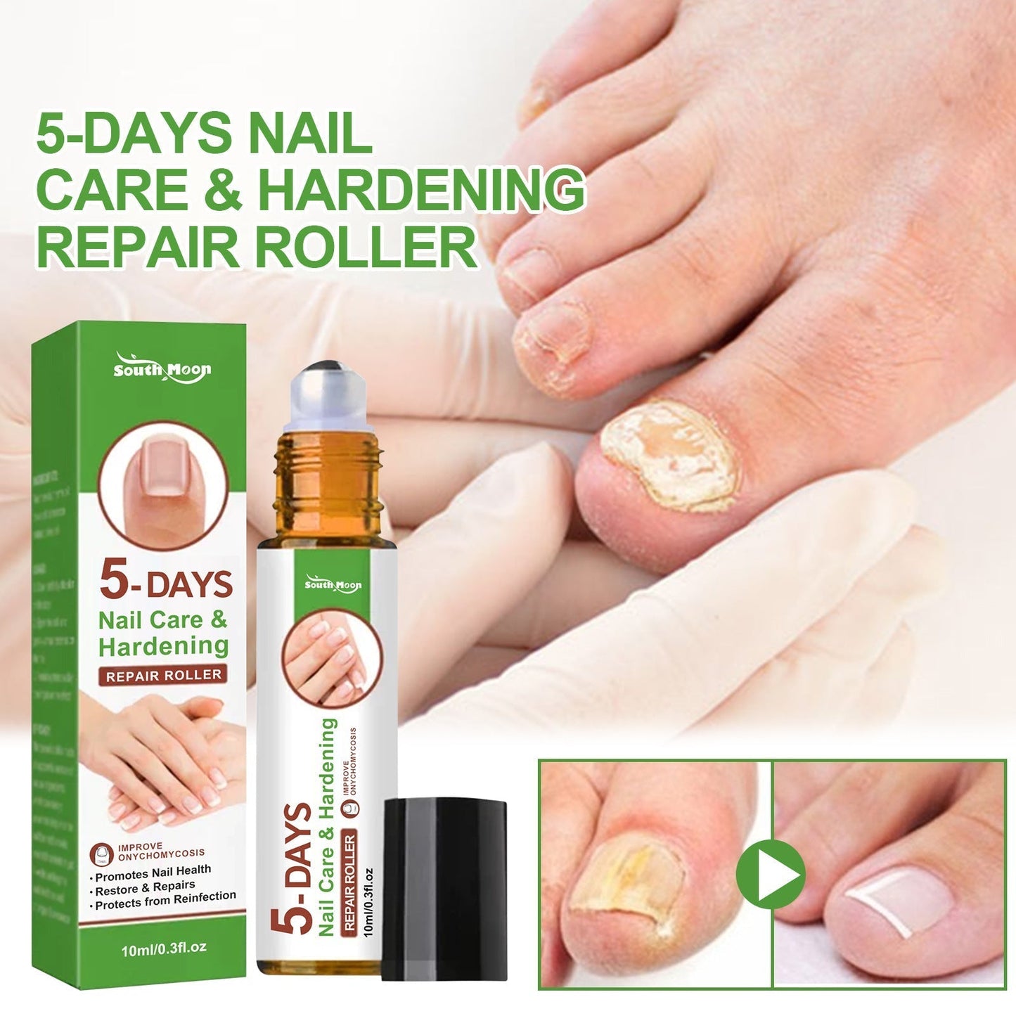 Roller soin ongles 10ml solution épaississante anti-fragilité pour ongles forts et réparés